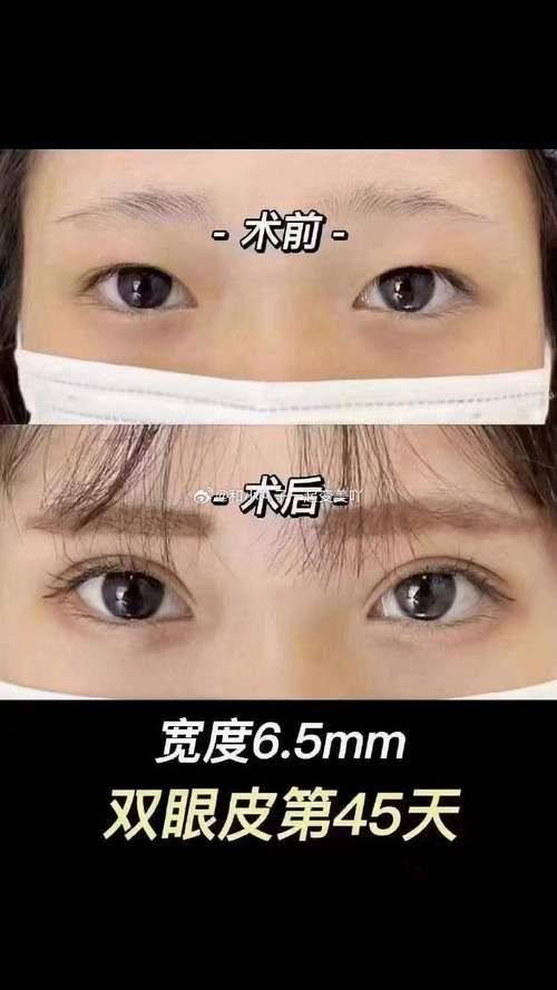 费书宇医生价格表