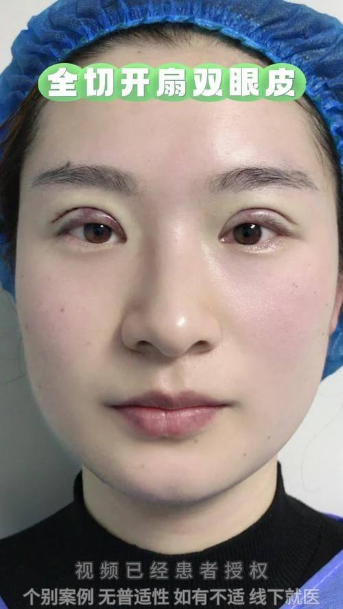 天津丽身小华医疗美容诊所收费价格表/收费标准