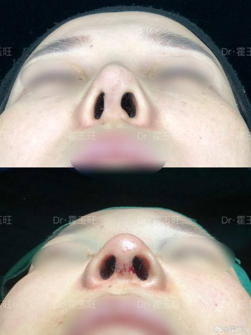 口碑评价及真人实例