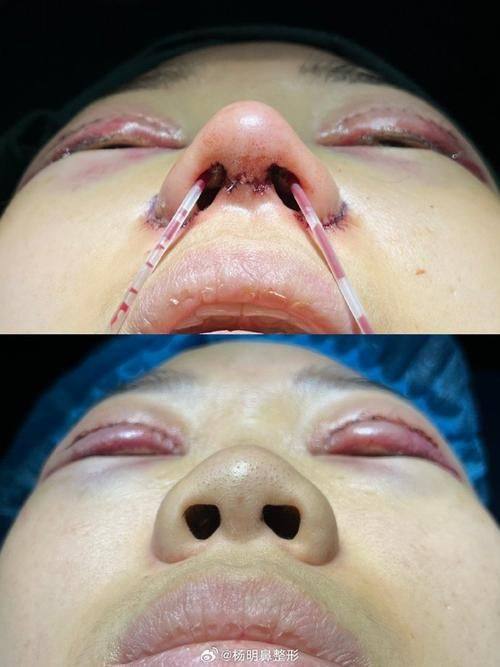 王佑兴医生擅长项目