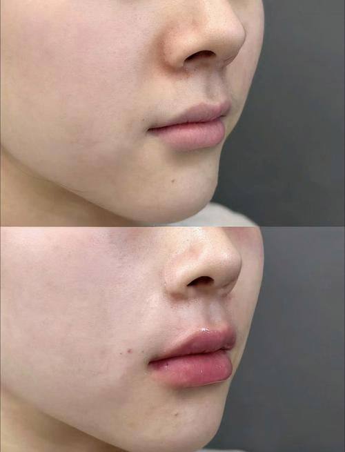 襄阳爱尚美整形医院特色项目及技术优势