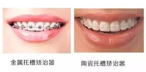 候秀奇医生坐诊医院