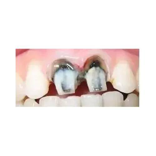 广东云浮同泽口腔门诊部真人口碑评价怎么样？