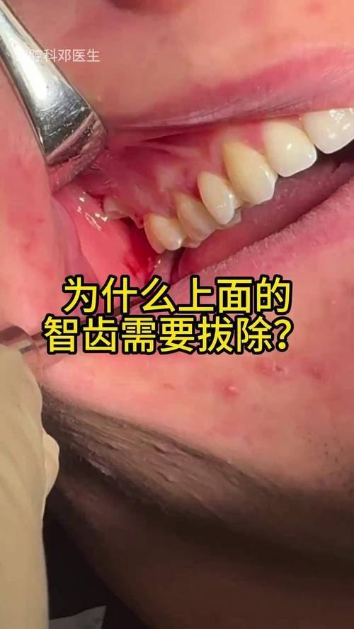 口碑评价及真人实例