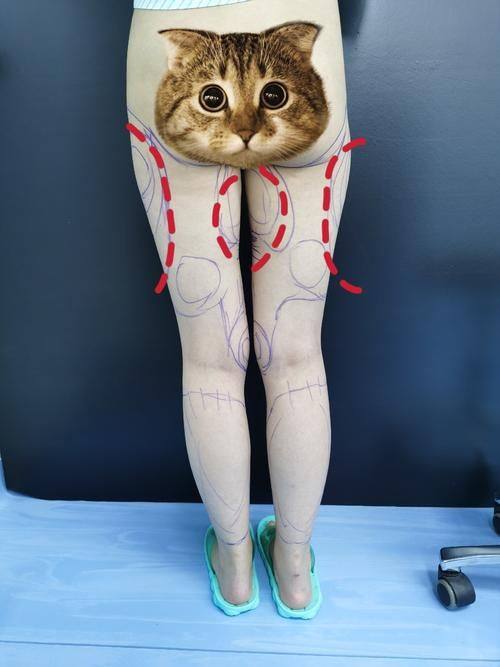 费书宇医生预约挂号