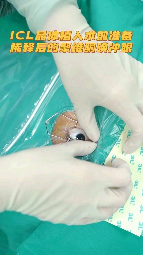 郎莉莉医生口碑评价及真人实例