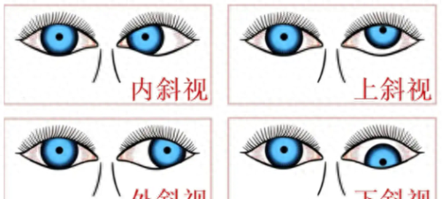 王曜医生擅长项目