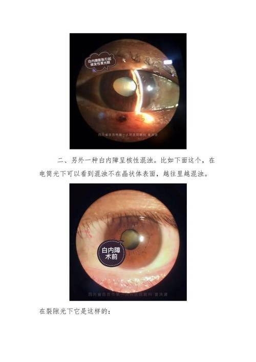 陕西咸阳爱尔眼科医院特色项目及技术优势