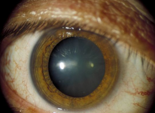 李争春医生坐诊医院