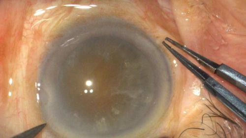 郎莉莉医生擅长项目