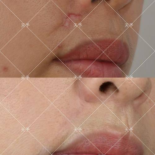 王佑兴医生价格表