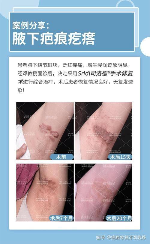 王佑兴医生技术优势