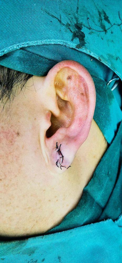 襄阳爱尚美整形医院真人口碑评价怎么样？