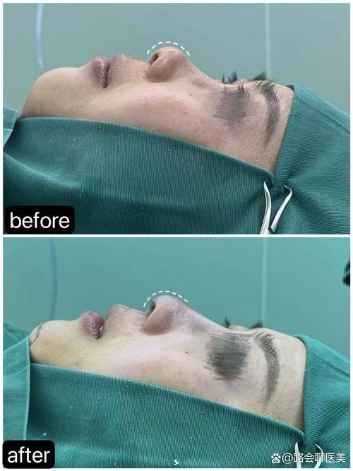 泸州韩美医疗美容整形门诊部特色项目及技术优势