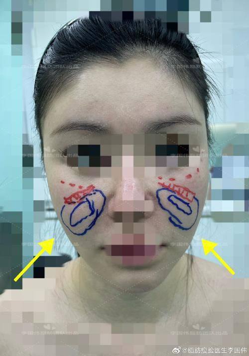 南宁慧美医疗美容收费价格表/收费标准