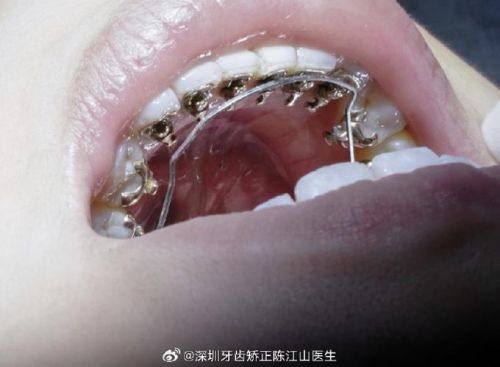 南京瑞臻口腔是正规医院吗？