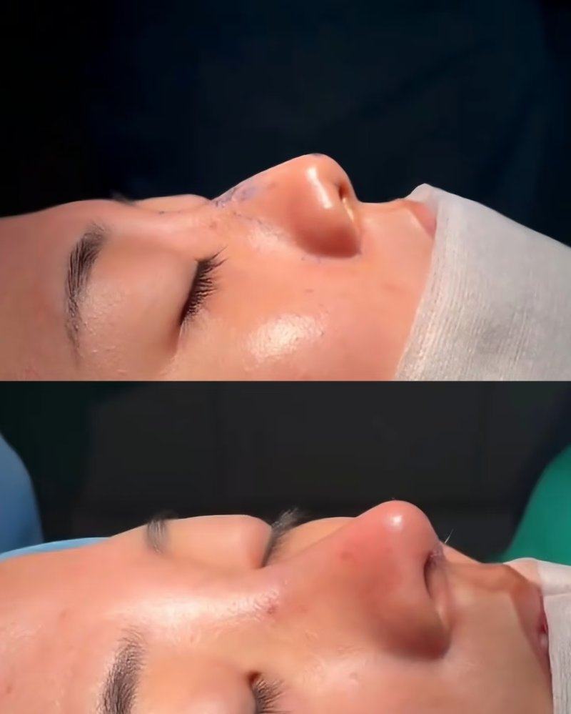 刘芳利医生擅长项目