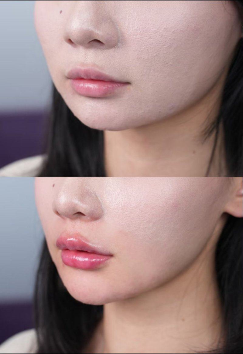 福州莎菲琳弘宇整形医院是正规医院吗？