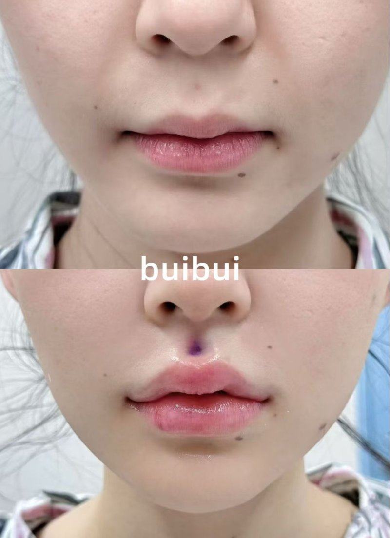 福州莎菲琳弘宇整形医院详细的预约挂号方式及流程