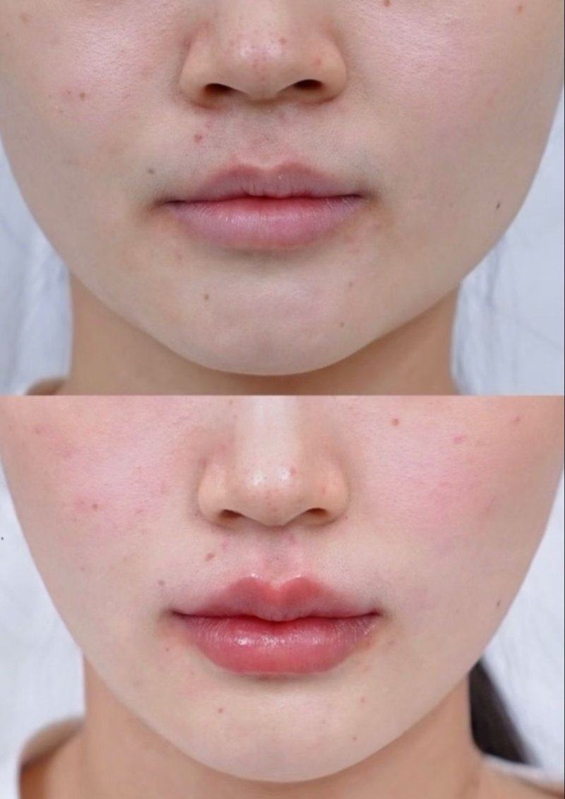 福州莎菲琳弘宇整形医院地址电话营业时间