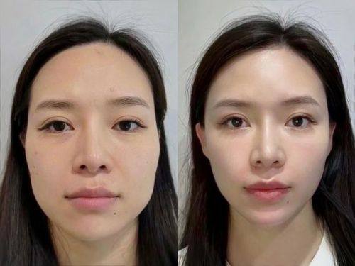 哈尔滨王医生医学美容门诊部收费价格表/收费标准