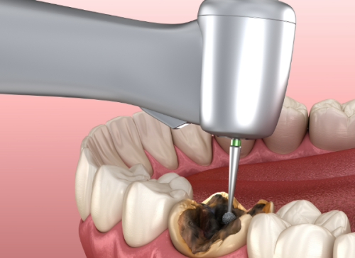 三明尤溪县谦亨牙状元口腔详细的预约挂号方式及流程