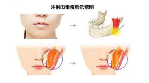 长沙俪姿整形医院地址电话营业时间
