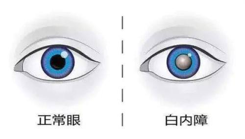 海口康伟眼科门诊部特色项目及技术优势