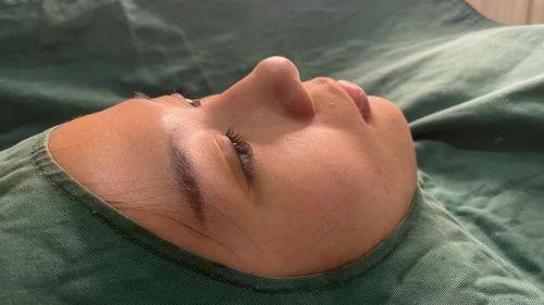 乐清奥拉克医疗美容诊所真人口碑评价怎么样？