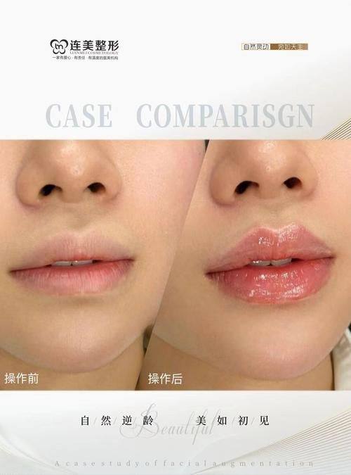 厦门思明李如英天使医学美容医院地址电话营业时间