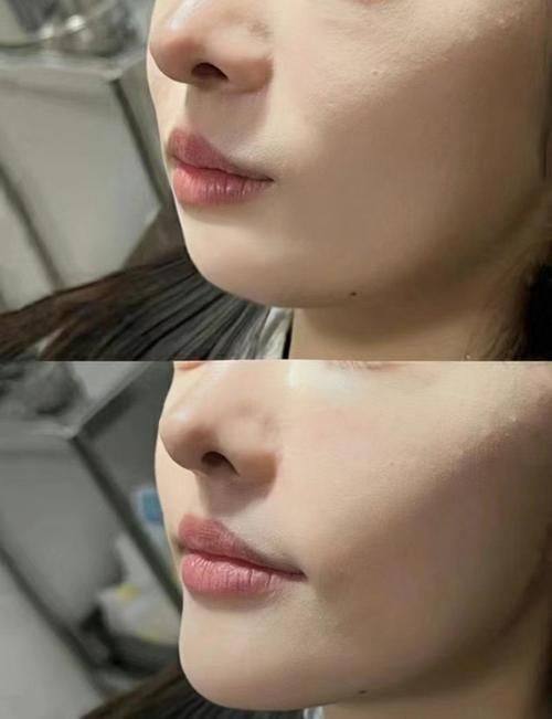 哈尔滨王医生医学美容门诊部真人口碑评价怎么样？