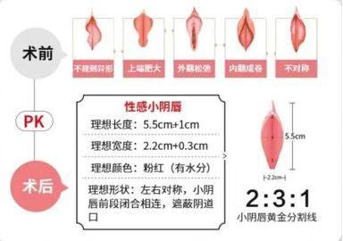 长沙俪姿整形医院是正规医院吗？