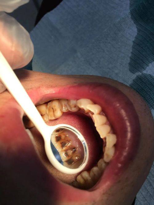 深圳李焕球口腔诊所地址电话营业时间