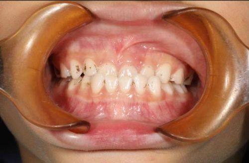 重庆瑞佳口腔门诊收费价格表/收费标准