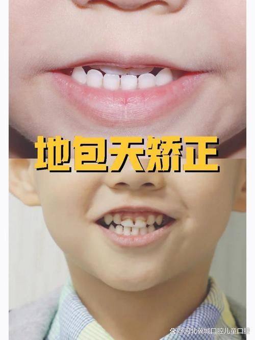 重庆瑞佳口腔门诊真人口碑评价怎么样？