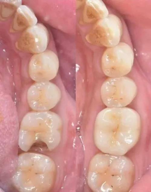 樟树市方正口腔门诊部真人口碑评价怎么样？