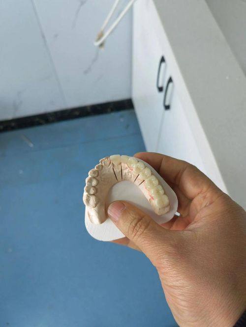 盱眙县牙博仕口腔门诊部详细的预约挂号方式及流程