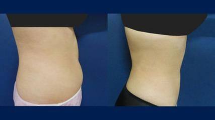 揭阳榕江医院医疗美容科是正规医院吗？