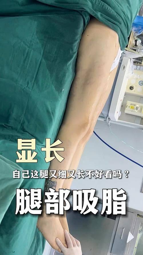 厦门思明李如英天使医学美容医院收费价格表/收费标准