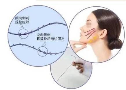 韩国YOU&I皮肤科医院详细的预约挂号方式及流程