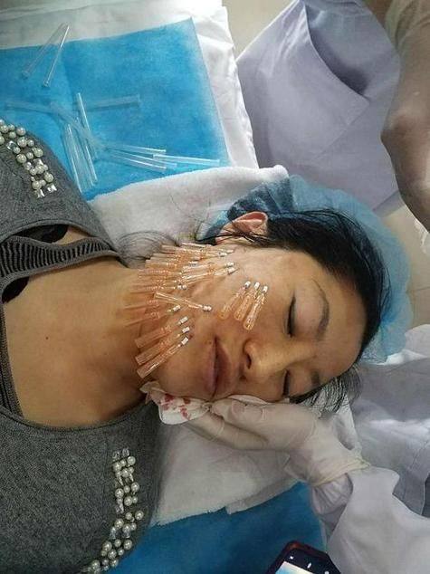 韩国YOU&I皮肤科医院真人口碑评价怎么样？