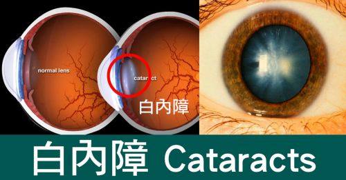 咸宁市中医医院眼科特色项目及技术优势