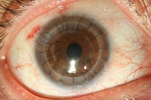 咸宁市中医医院眼科真人口碑评价怎么样？