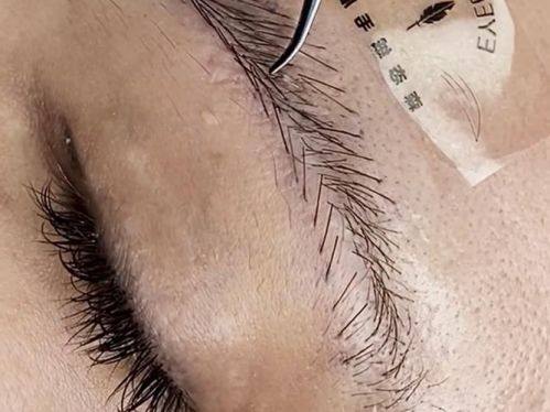 厦门思明李如英天使医学美容医院是正规医院吗？