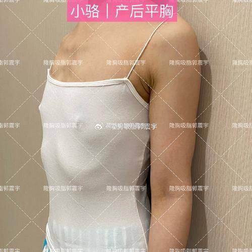 哈尔滨王医生医学美容门诊部详细的预约挂号方式及流程