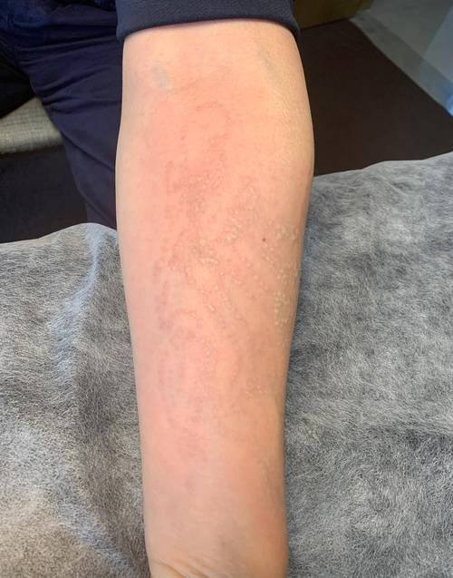 长沙俪姿整形医院收费价格表/收费标准