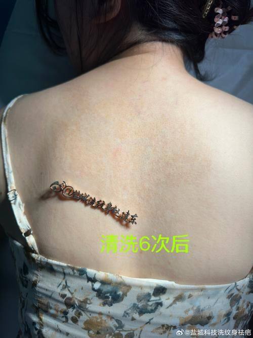 长沙俪姿整形医院特色项目及技术优势