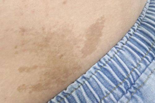 侯艳萍医生价格表