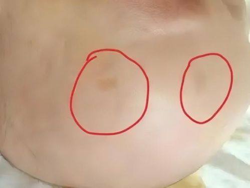 侯艳萍医生擅长项目