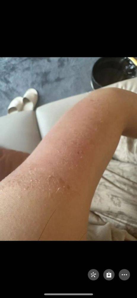 侯艳萍医生口碑评价及真人实例